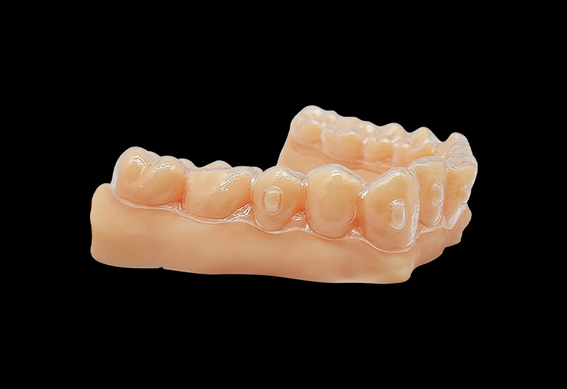 什么是3d打印正畸牙模？3d打印正畸牙模怎么做？